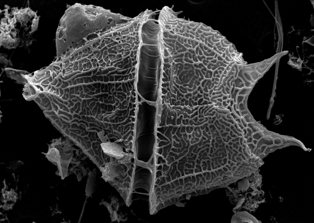 Представитель Семейства Gonyaulacaceae